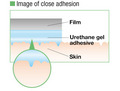 Image of close adhesion