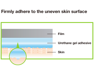 Adhesion illustration